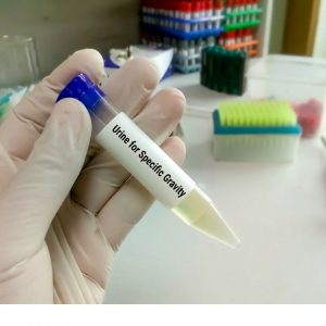 Urine for Specific Gravity